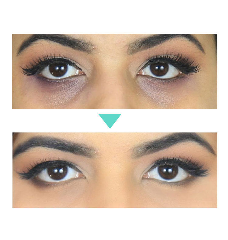 🌿 Anti-Aging Eye Cream 30ml – Dark Circle, Puffiness & Wrinkle Repair Formula