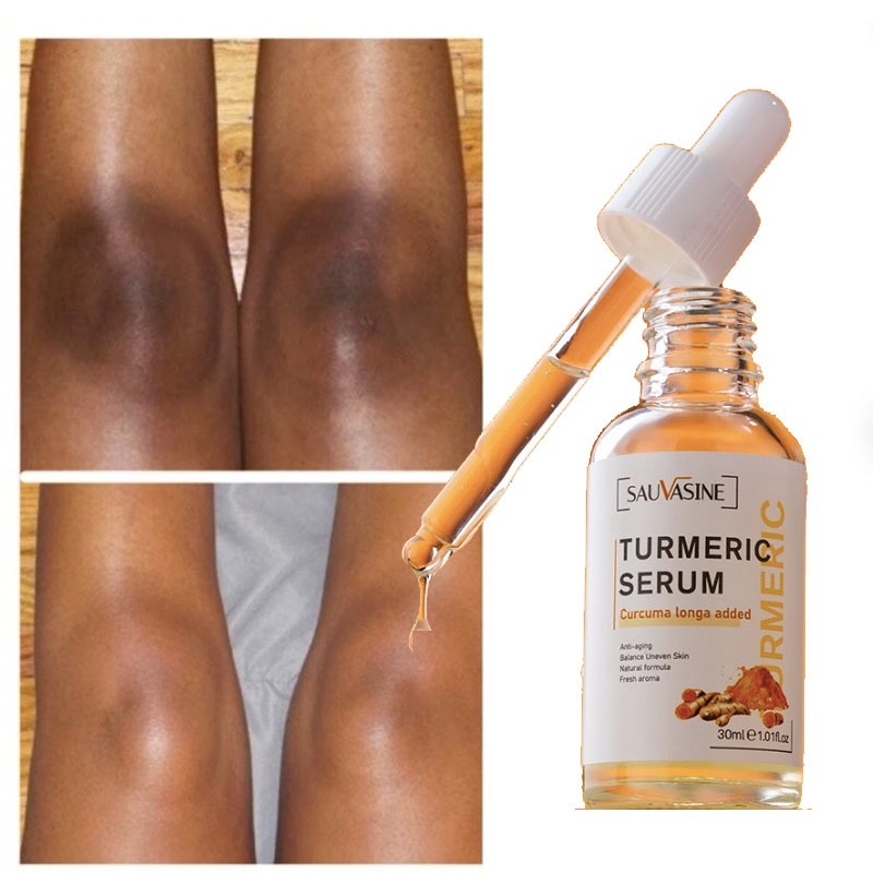 Turmeric Lemon Glow Serum for Dark Spots & Smooth Skin