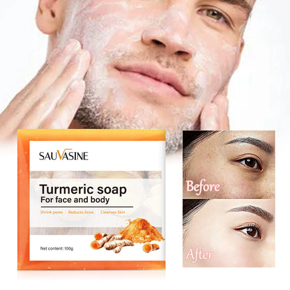 Turmeric Lemon Glow Serum for Dark Spots & Smooth Skin